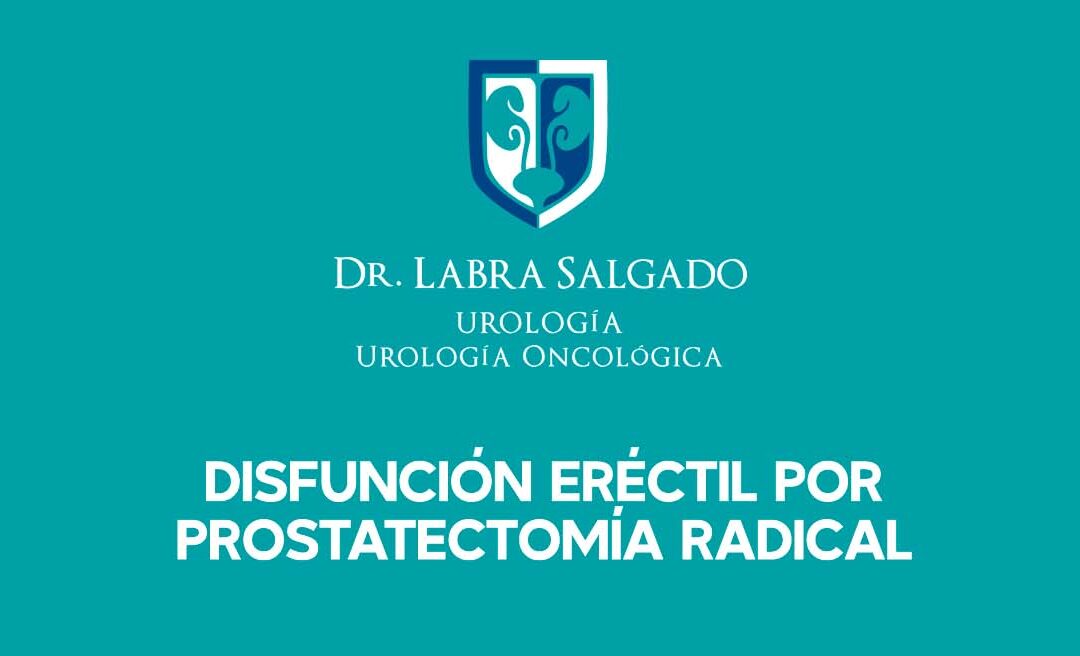 Disfunción eréctil, luego de una prostatectomía radical por cáncer de próstata.