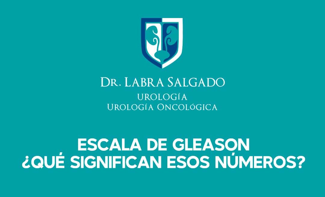 Escala de Gleason para el cáncer de próstata