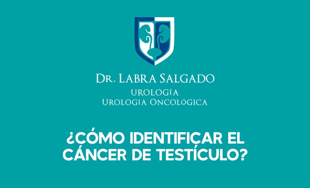 Cáncer de testículo, signos de alerta.