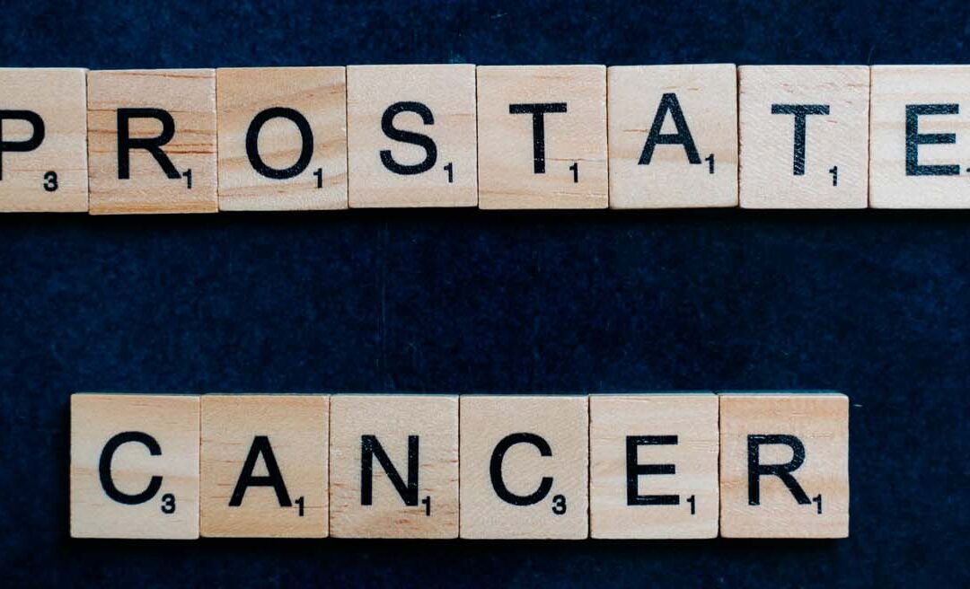 No realizar suficientes pruebas de detección de rutina de antígeno prostático, elevó la incidencia de metástasis en cáncer de próstata.